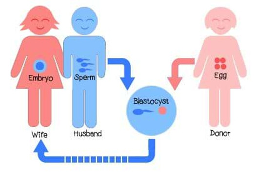 Donor Egg IVF Treatment in Delhi