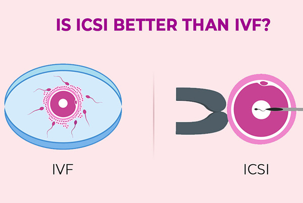 Comparison between ICSI IVF & General IVF Treatment in Term of Success or Cost in Delhi